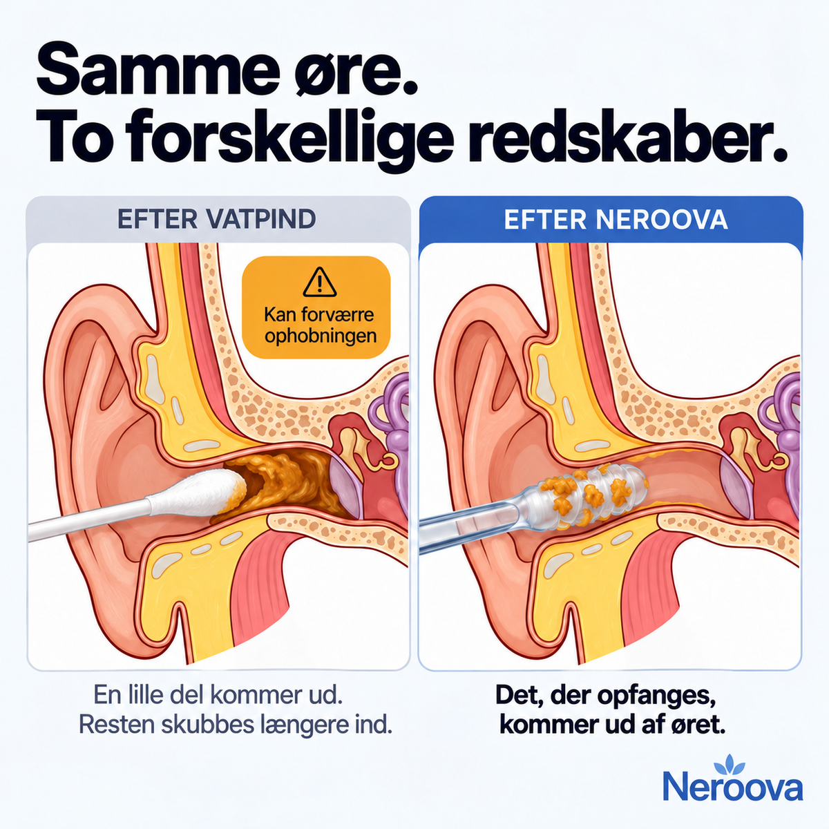 Neroova™ - Den selvklæbende ørepind